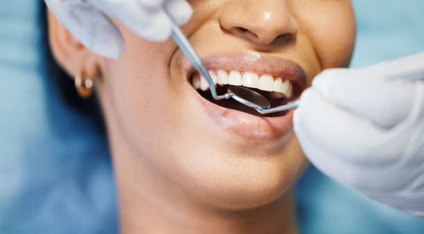 Best Emergency Tooth Extraction  in Shady Hills, FL