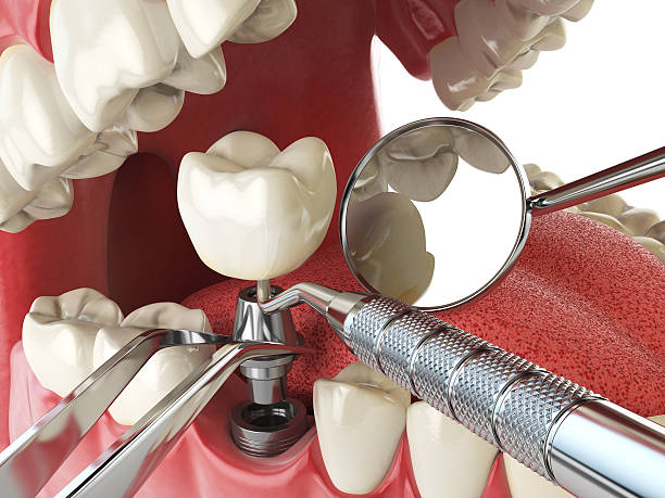 Best Broken Tooth Emergency  in Shady Hills, FL