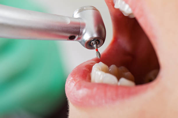 Best Broken Tooth Emergency  in Shady Hills, FL